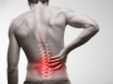 Exercise for low back pain beneficial but no one a